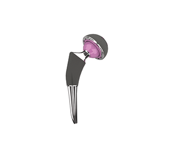 Ceramic Biological Total Hip Arthroplasty (THA) System